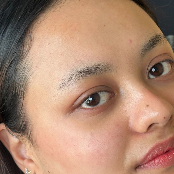 Before brow transformation 1