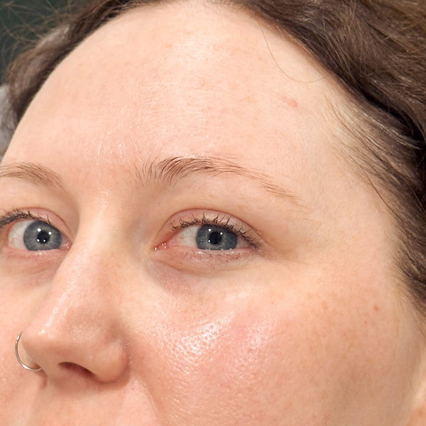 Before brow transformation 3